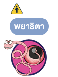 พยาธินัยน์ตา (eye worms)