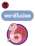 พยาธิในปอด (Lungworm)